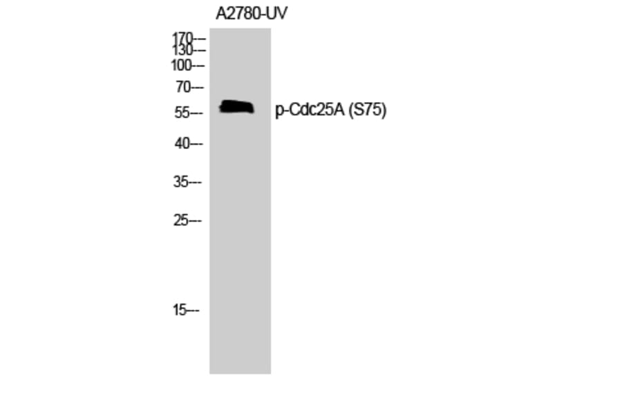 Western Blot - Anti-CDC25A (phospho Ser75) Antibody (A7037) - Antibodies.com