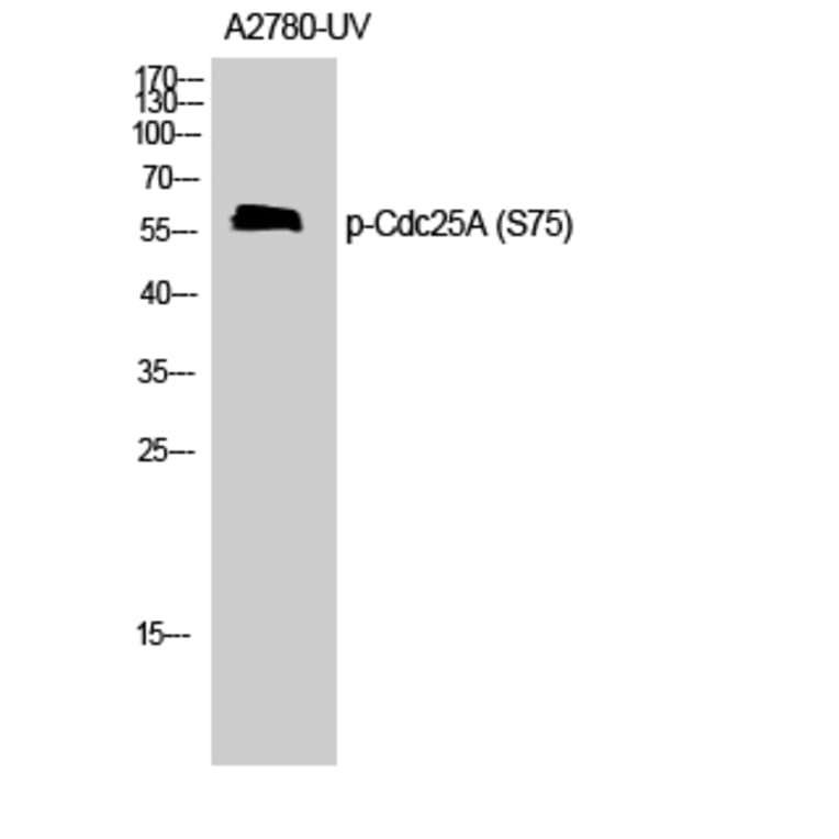 Western Blot - Anti-CDC25A (phospho Ser75) Antibody (A7037) - Antibodies.com