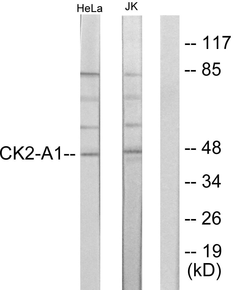 おまとめ【fl23】【cal18】【cal19】【cal20】【aph9】 PFOA Promotes Hepatocellular Carcinoma Cell Progression by
