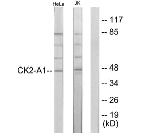 Western Blot - Anti-Casein Kinase II alpha Antibody (B1192) - Antibodies.com