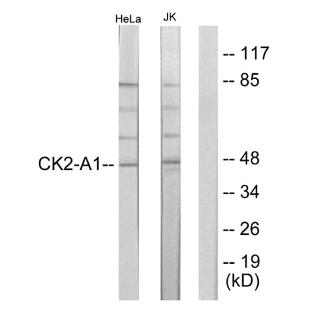 Western Blot - Anti-Casein Kinase II alpha Antibody (B1192) - Antibodies.com