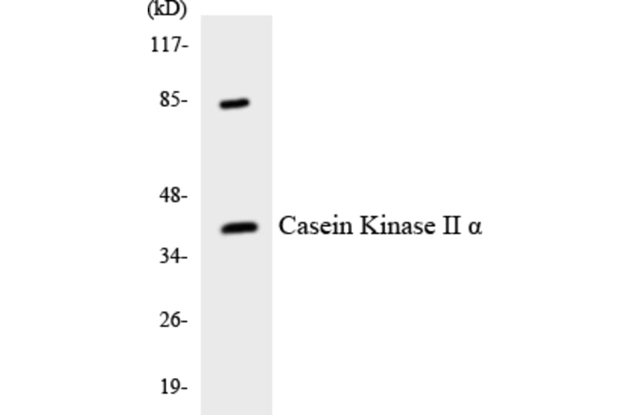 Western Blot - Anti-Casein Kinase II alpha Antibody (R12-2570) - Antibodies.com