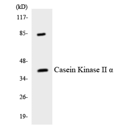 Western Blot - Anti-Casein Kinase II alpha Antibody (R12-2570) - Antibodies.com