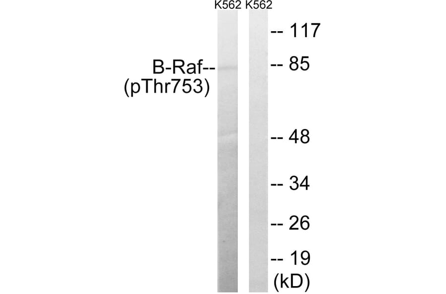 Western Blot - Anti-B-Raf (phospho Thr753) Antibody (A8305) - Antibodies.com