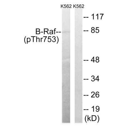 Western Blot - Anti-B-Raf (phospho Thr753) Antibody (A8305) - Antibodies.com