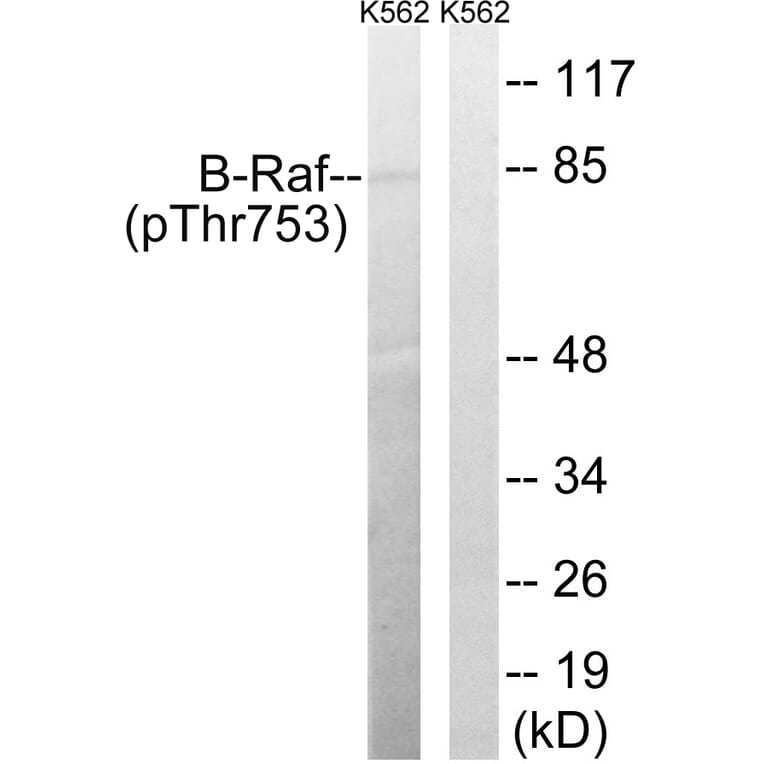 Western Blot - Anti-B-Raf (phospho Thr753) Antibody (A8305) - Antibodies.com