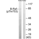 Western Blot - Anti-B-Raf (phospho Thr753) Antibody (A8305) - Antibodies.com