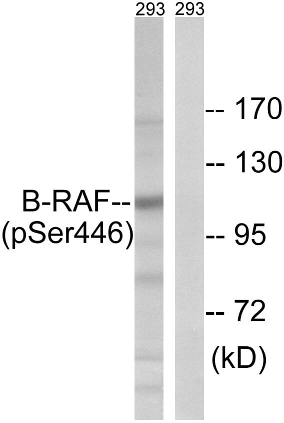 B Raf Antibodies | Antibodies.com