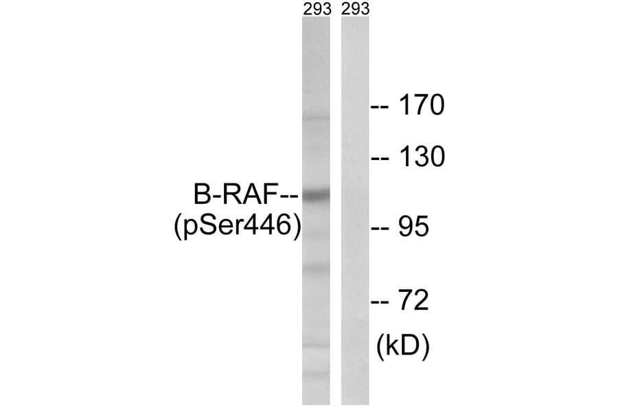Western Blot - Anti-B-RAF (phospho Ser446) Antibody (A8082) - Antibodies.com