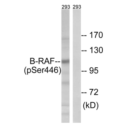 Western Blot - Anti-B-RAF (phospho Ser446) Antibody (A8082) - Antibodies.com
