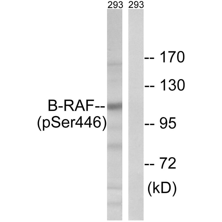 Western Blot - Anti-B-RAF (phospho Ser446) Antibody (A8082) - Antibodies.com