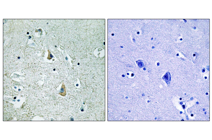 Immunohistochemistry - Anti-B-RAF (phospho Ser446) Antibody (A8082) - Antibodies.com