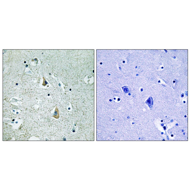 Immunohistochemistry - Anti-B-RAF (phospho Ser446) Antibody (A8082) - Antibodies.com