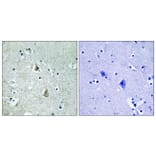Immunohistochemistry - Anti-B-RAF (phospho Ser446) Antibody (A8082) - Antibodies.com