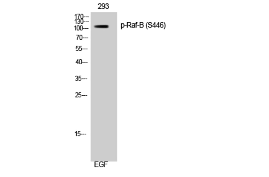 Western Blot - Anti-B-RAF (phospho Ser446) Antibody (A8082) - Antibodies.com