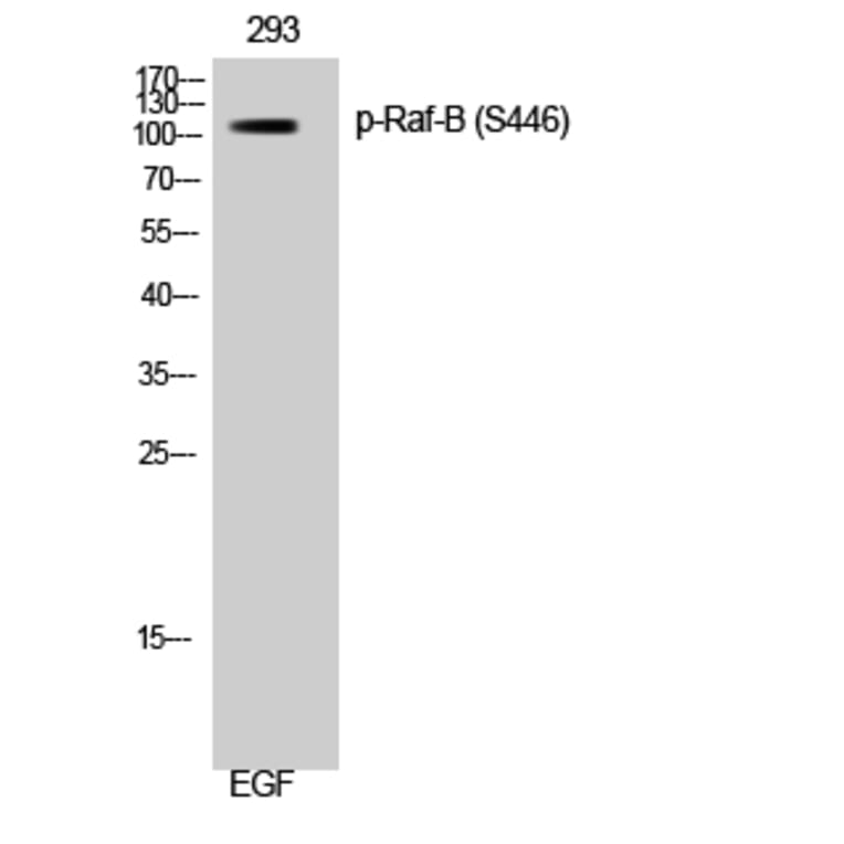 Western Blot - Anti-B-RAF (phospho Ser446) Antibody (A8082) - Antibodies.com