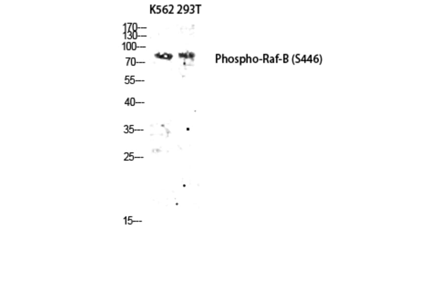 Western Blot - Anti-B-RAF (phospho Ser446) Antibody (A8082) - Antibodies.com