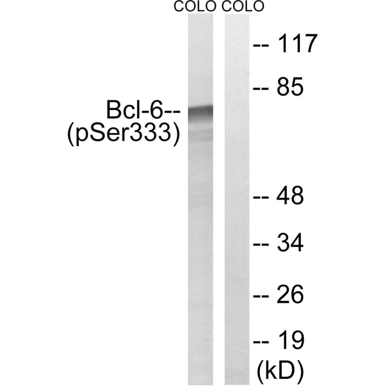 Western Blot - Anti-Bcl-6 (phospho Ser333) Antibody (A8299) - Antibodies.com