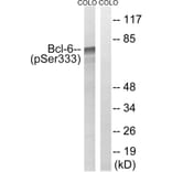 Western Blot - Anti-Bcl-6 (phospho Ser333) Antibody (A8299) - Antibodies.com