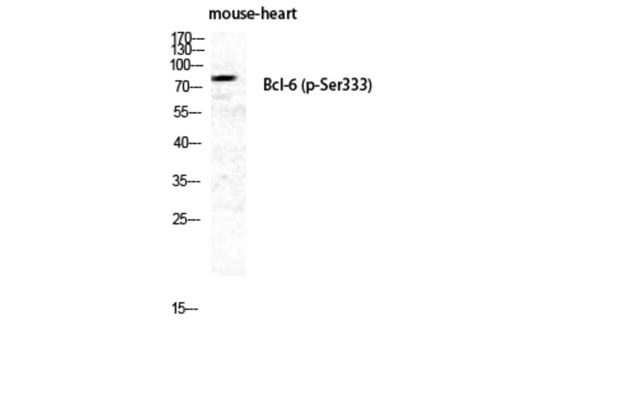 Western Blot - Anti-Bcl-6 (phospho Ser333) Antibody (A8299) - Antibodies.com