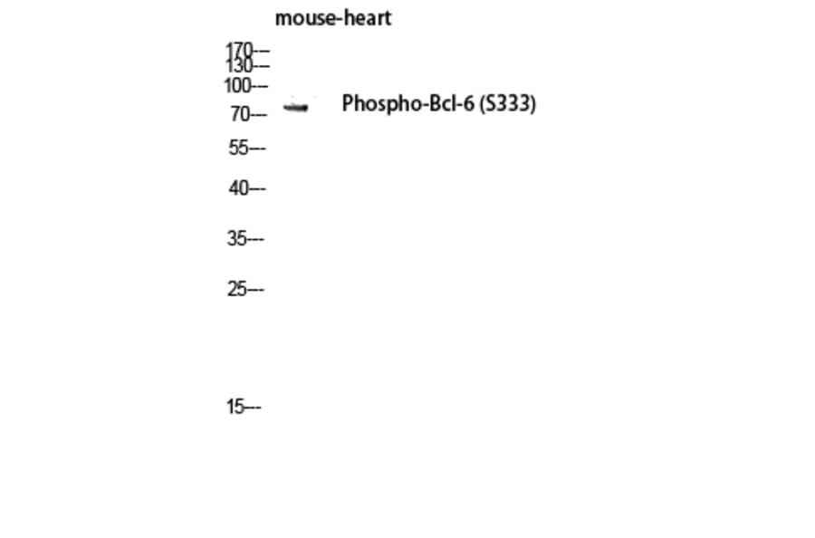 Western Blot - Anti-Bcl-6 (phospho Ser333) Antibody (A8299) - Antibodies.com