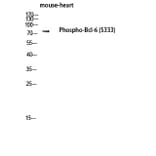 Western Blot - Anti-Bcl-6 (phospho Ser333) Antibody (A8299) - Antibodies.com