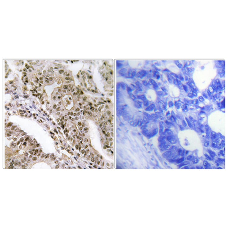 Immunohistochemistry - Anti-AS160 (phospho Thr642) Antibody (A0457) - Antibodies.com