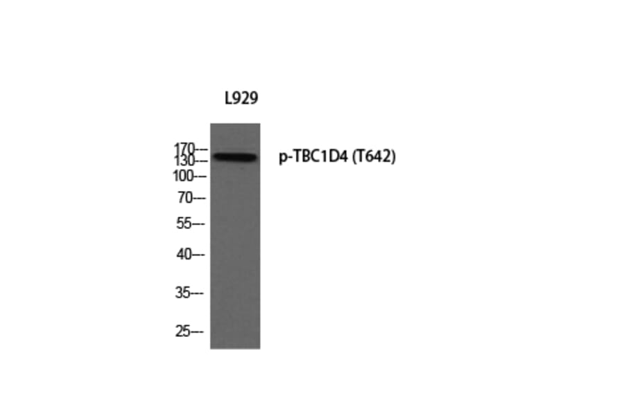 Western Blot - Anti-AS160 (phospho Thr642) Antibody (A0457) - Antibodies.com