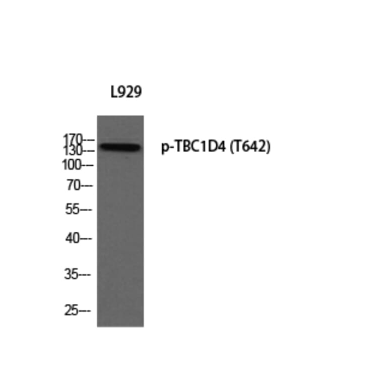 Western Blot - Anti-AS160 (phospho Thr642) Antibody (A0457) - Antibodies.com