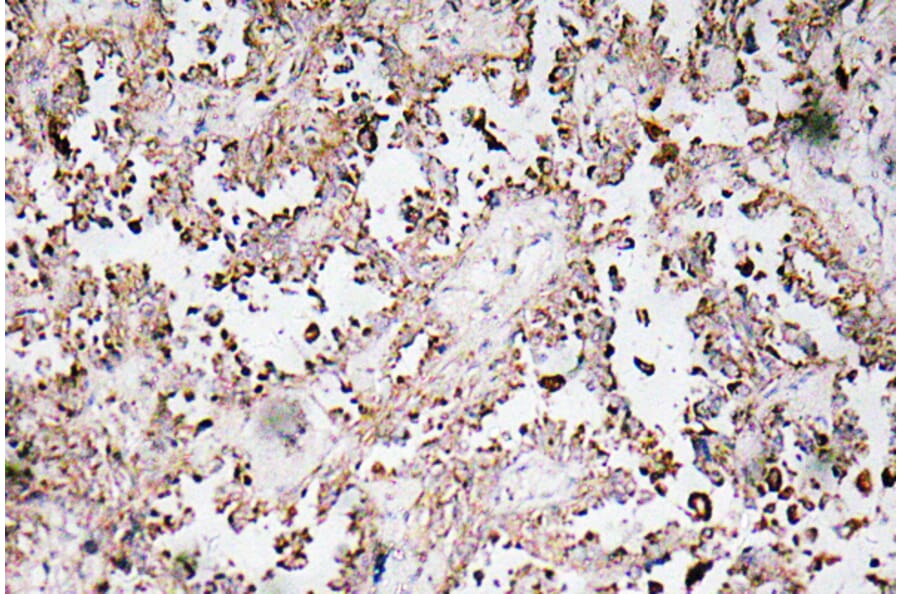 Immunohistochemistry - Anti-VAMP1 + VAMP2 + VAMP3 Antibody (R12-2405) - Antibodies.com
