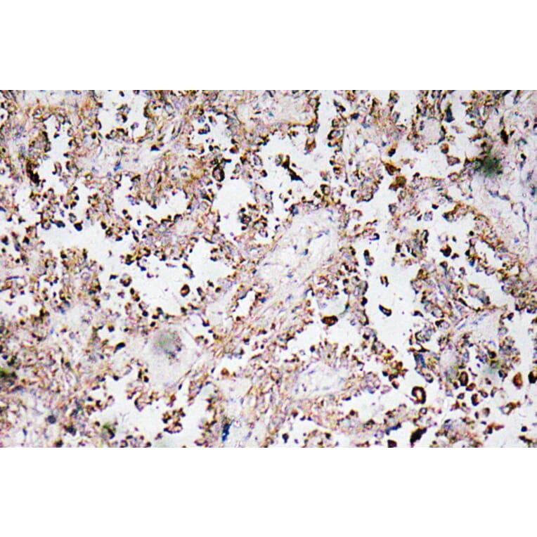 Immunohistochemistry - Anti-VAMP1 + VAMP2 + VAMP3 Antibody (R12-2405) - Antibodies.com
