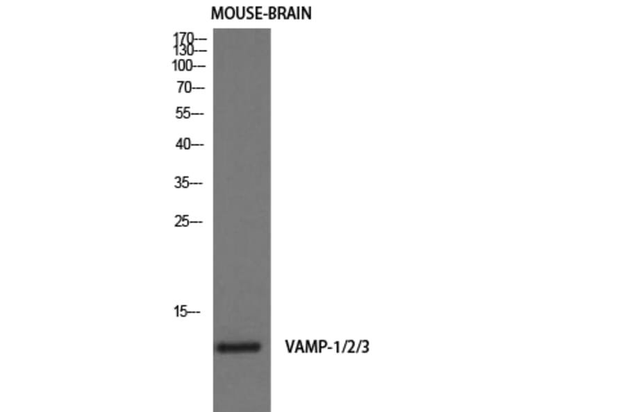 Western Blot - Anti-VAMP1 + VAMP2 + VAMP3 Antibody (R12-2405) - Antibodies.com