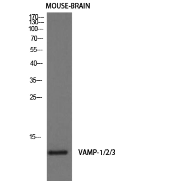 Western Blot - Anti-VAMP1 + VAMP2 + VAMP3 Antibody (R12-2405) - Antibodies.com