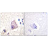 Immunohistochemistry - Anti-SEK1 (phospho Ser257) Antibody (A1122) - Antibodies.com