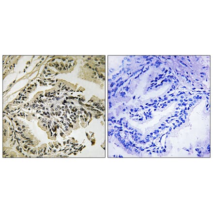 Immunohistochemistry - Anti-PERK (phospho Thr981) Antibody (A8168) - Antibodies.com