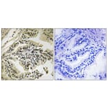 Immunohistochemistry - Anti-PERK (phospho Thr981) Antibody (A8168) - Antibodies.com