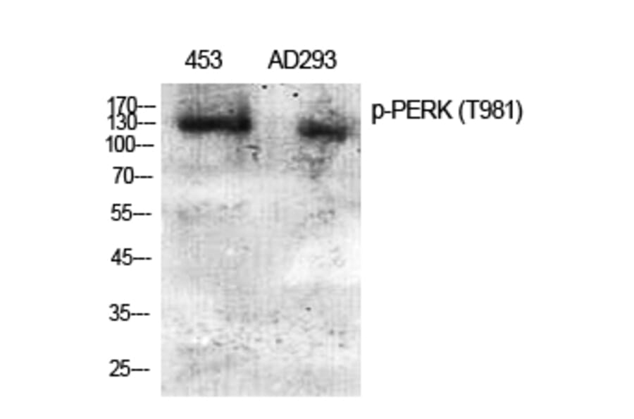 Western Blot - Anti-PERK (phospho Thr981) Antibody (A8168) - Antibodies.com
