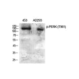 Western Blot - Anti-PERK (phospho Thr981) Antibody (A8168) - Antibodies.com