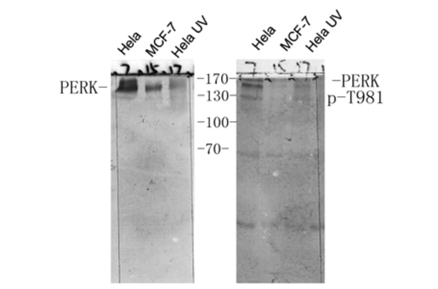 Western Blot - Anti-PERK (phospho Thr981) Antibody (A8168) - Antibodies.com