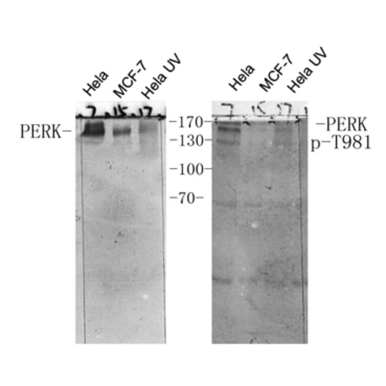 Western Blot - Anti-PERK (phospho Thr981) Antibody (A8168) - Antibodies.com