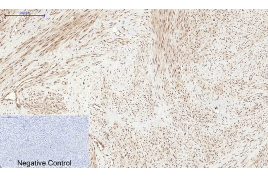 Immunohistochemistry - Anti-PERK (phospho Thr981) Antibody (A8168) - Antibodies.com