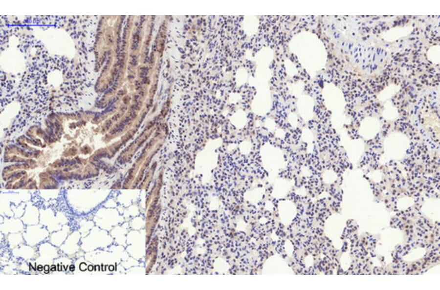 Immunohistochemistry - Anti-PERK (phospho Thr981) Antibody (A8168) - Antibodies.com