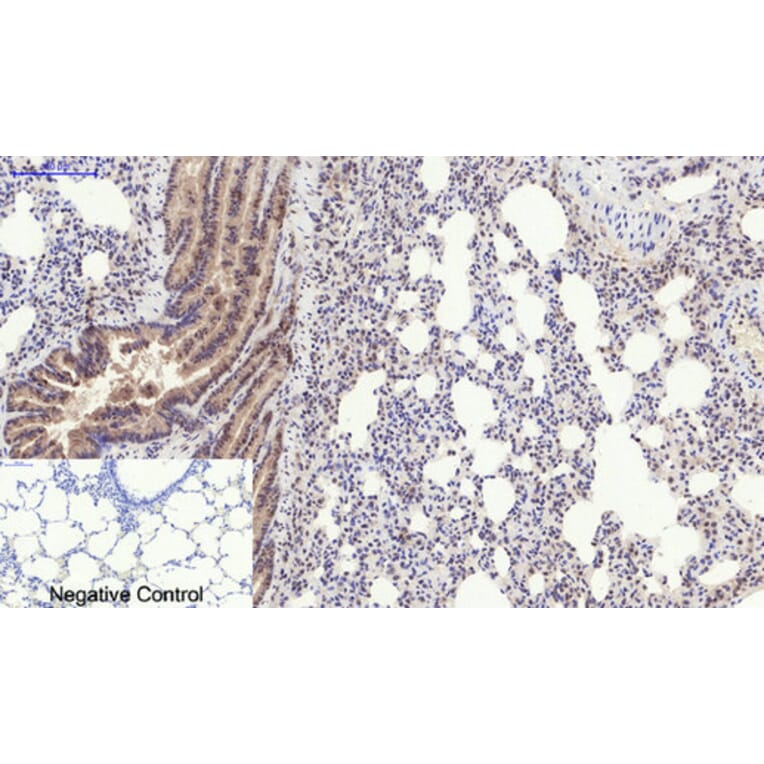 Immunohistochemistry - Anti-PERK (phospho Thr981) Antibody (A8168) - Antibodies.com