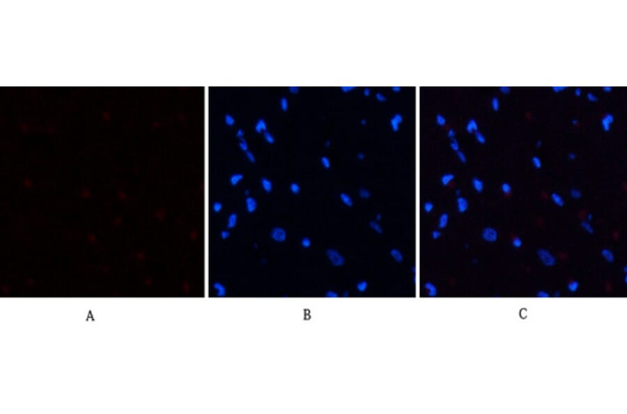 Immunofluorescence - Anti-PERK (phospho Thr981) Antibody (A8168) - Antibodies.com