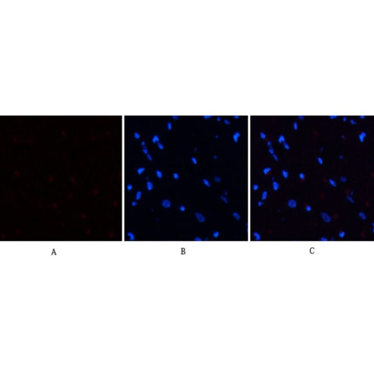 Immunofluorescence - Anti-PERK (phospho Thr981) Antibody (A8168) - Antibodies.com