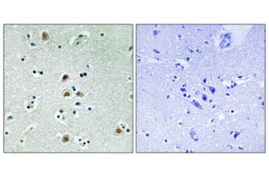Immunohistochemistry - Anti-CDK1 (phospho Thr161) Antibody (A8087) - Antibodies.com