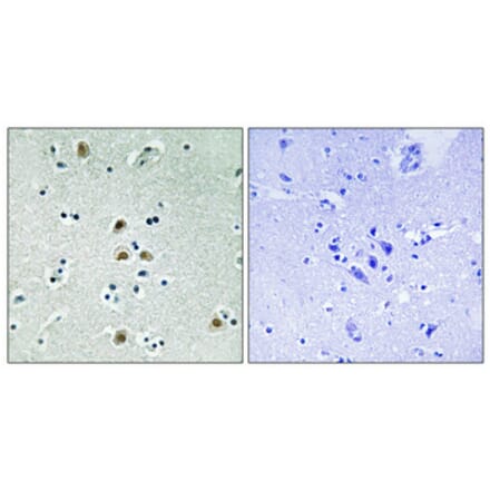 Immunohistochemistry - Anti-CDK1 (phospho Thr161) Antibody (A8087) - Antibodies.com