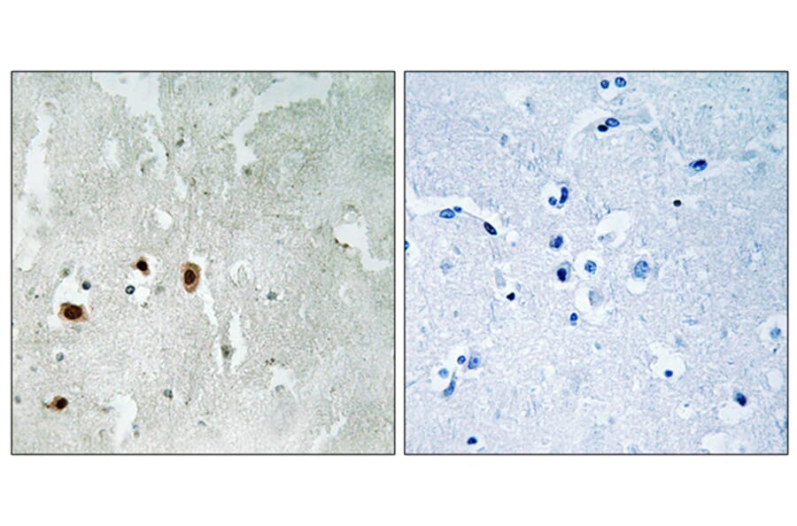 Immunohistochemistry - Anti-Tip60 (phospho Ser90) Antibody (A8434) - Antibodies.com