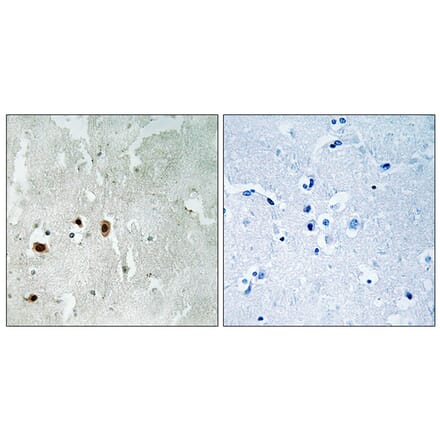 Immunohistochemistry - Anti-Tip60 (phospho Ser90) Antibody (A8434) - Antibodies.com
