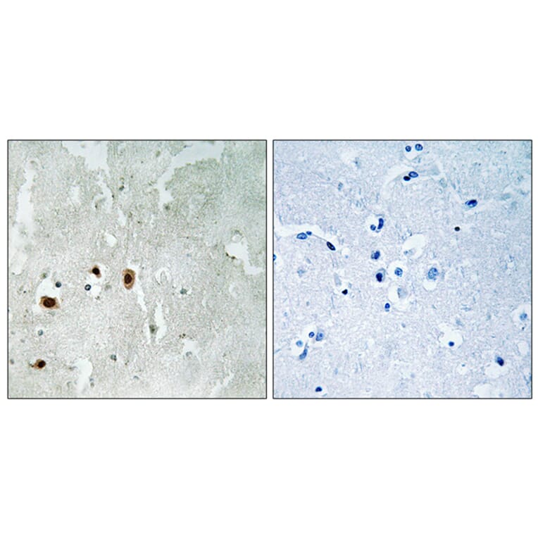 Immunohistochemistry - Anti-Tip60 (phospho Ser90) Antibody (A8434) - Antibodies.com